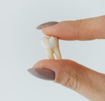 root canal vs extraction