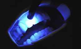 teeth cleaning price in Kenya clinic equipment