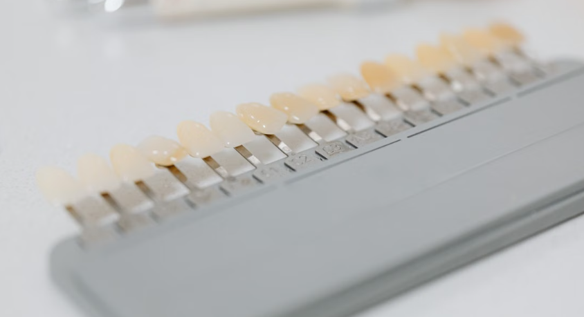 professional vs at-home whitening