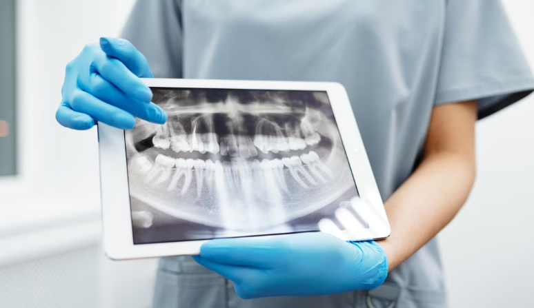 root canal vs extraction