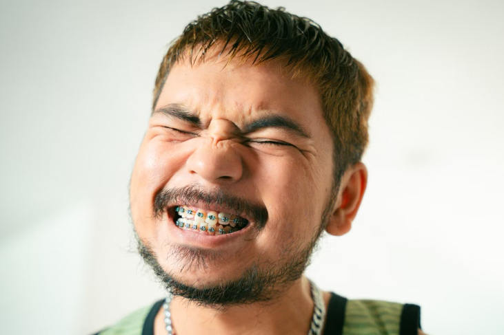 do braces hurt