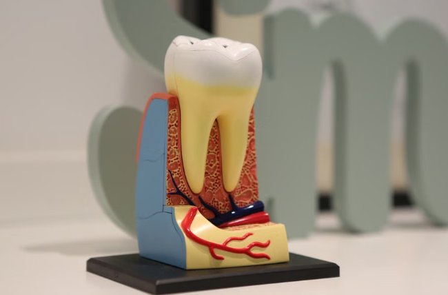 root canal cost in Kenya