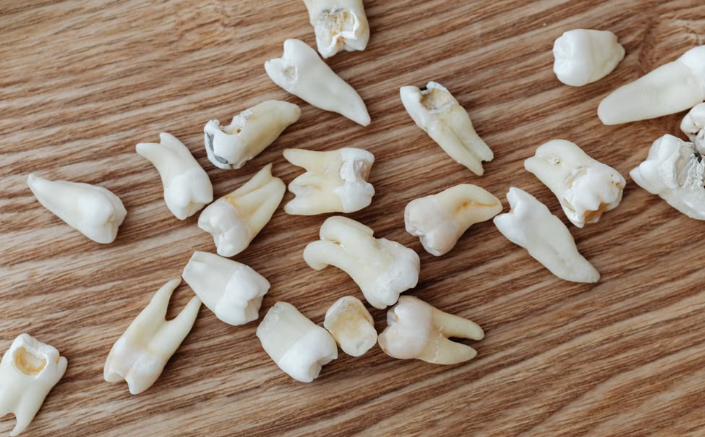 root canal cost in Kenya