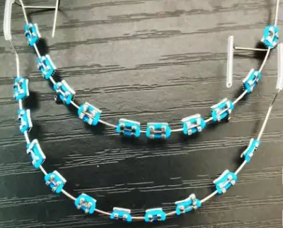 fashion braces