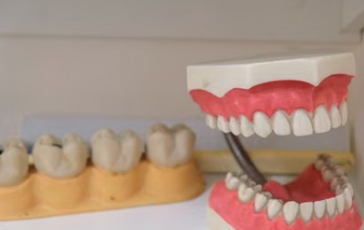 dental crown and bridge cost in Kenya