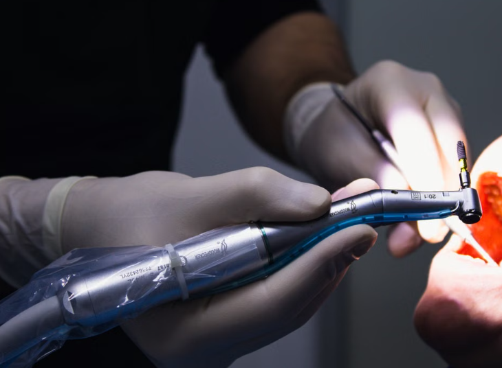 dental filling cost in Kenya