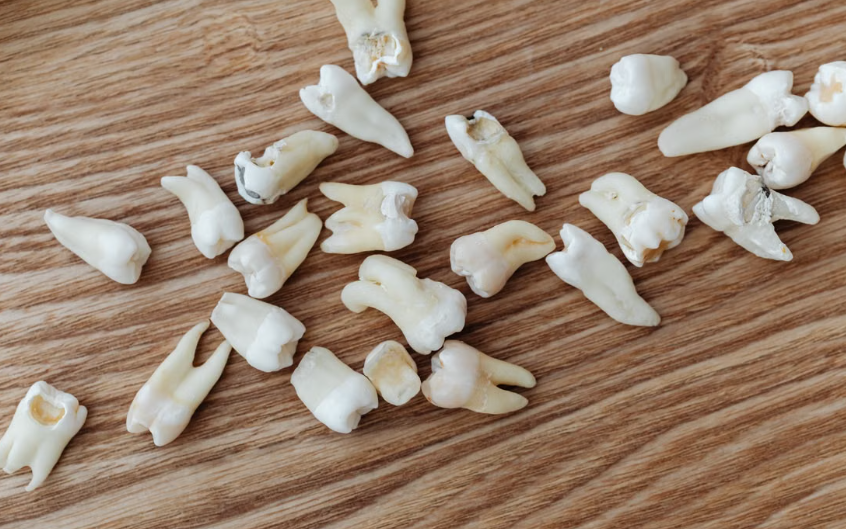 Dental Prices in Kenya
