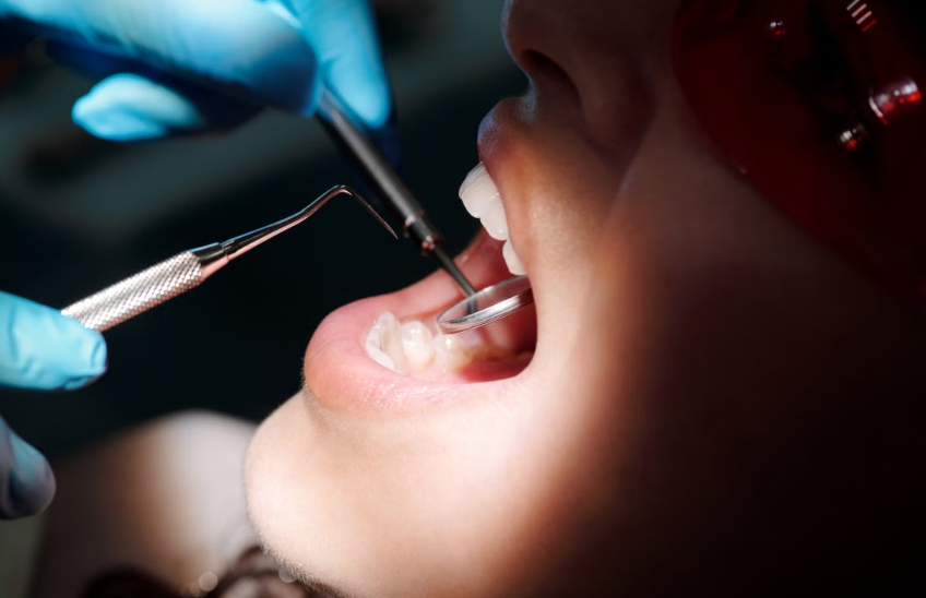 does teeth cleaning hurt
