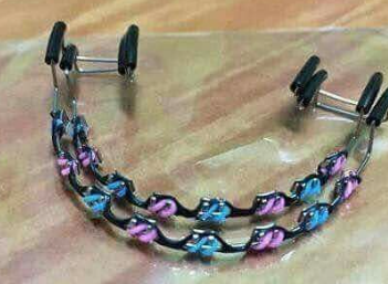 fashion braces