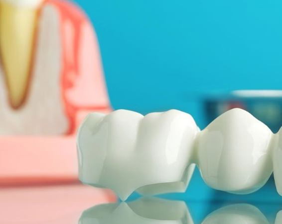 dental crown and bridge cost in Kenya