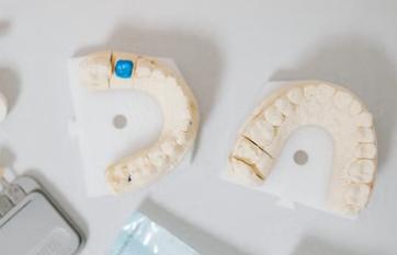 dental crown and bridge cost in Kenya