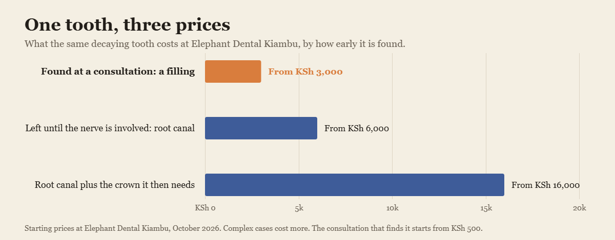 Chart showing why the dental checkup cost in Kenya is the cheapest appointment, against a filling, root canal and crown
