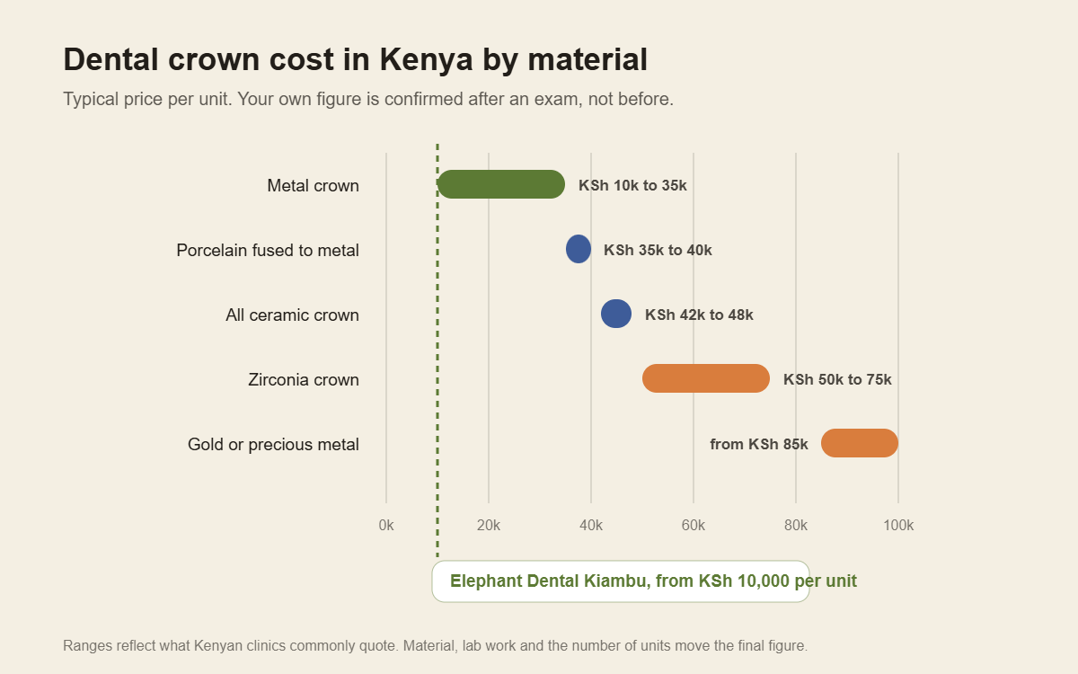 dental crown and bridge cost in Kenya: crown price per unit by material, metal from KSh 10,000 up to zirconia and gold