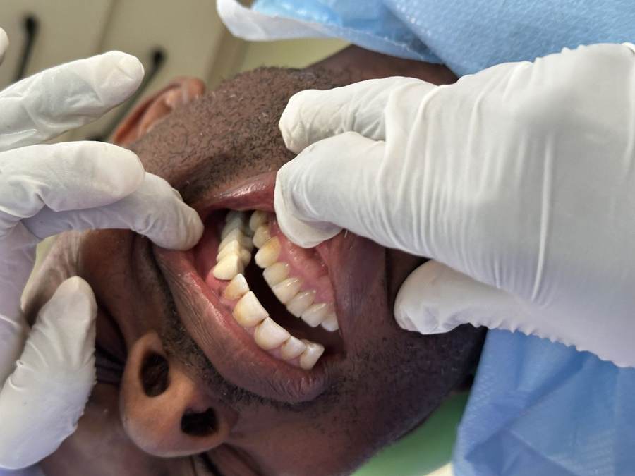 Precise, carefully performed dental procedure at Elephant Dental Kiambu
