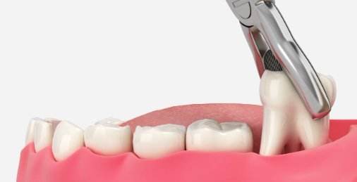 Ongoing routine care and maintenance at Elephant Dental Kiambu