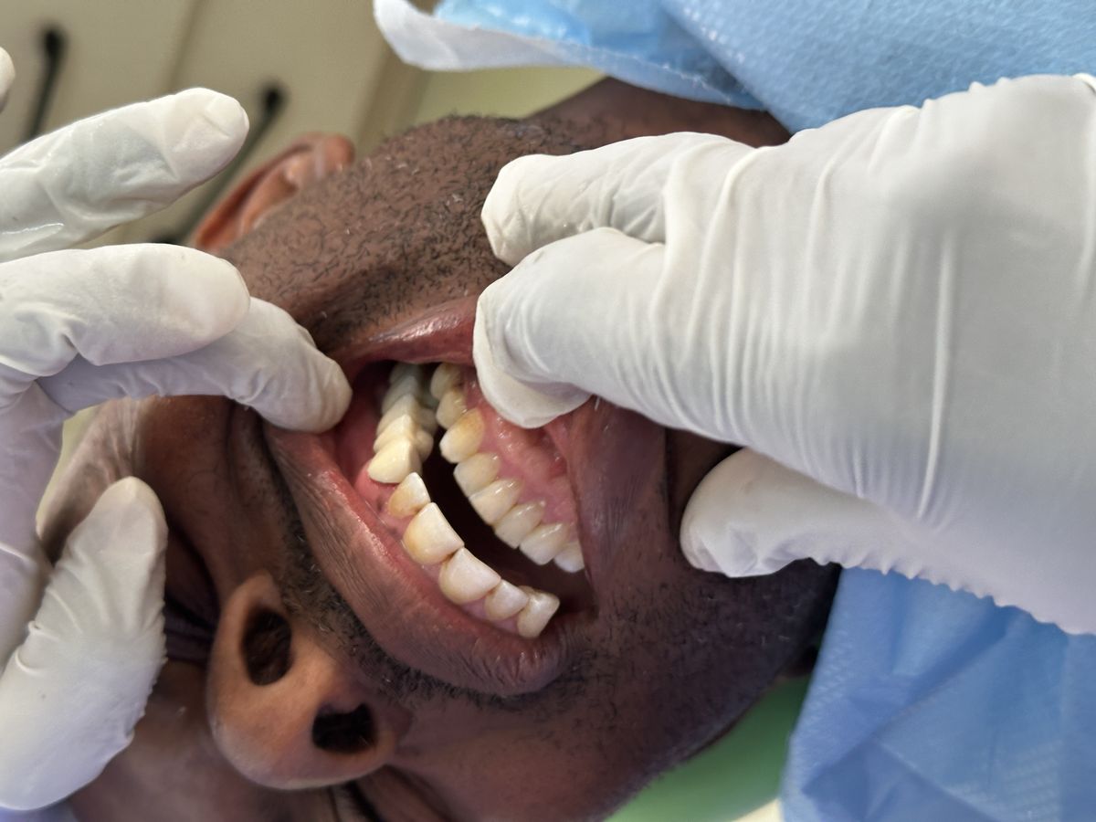 Denture fitting and installation procedure at Elephant Dental Kiambu Branch