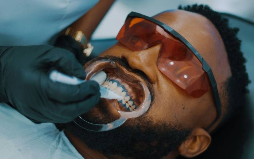 Supervised in clinic teeth whitening treatment at Elephant Dental Kiambu